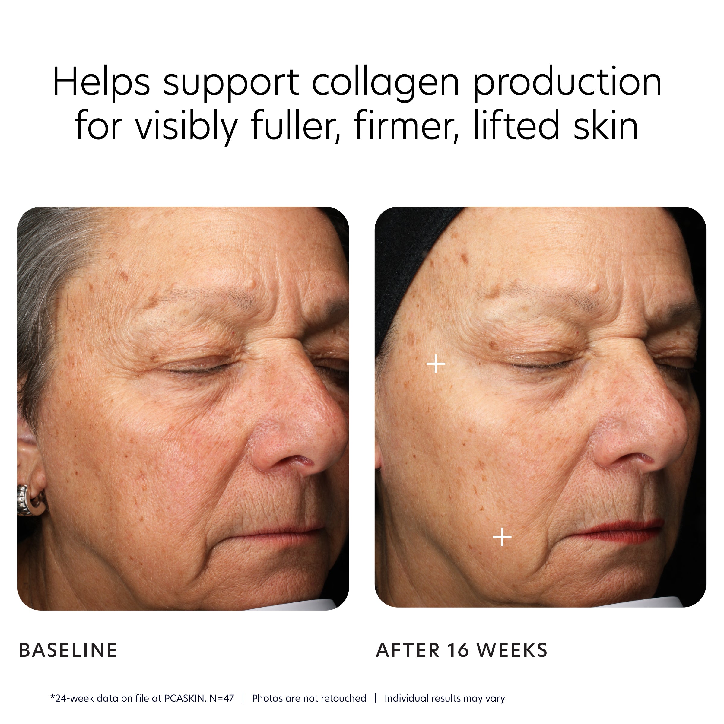 MGF Age Renewal Cream | Rich Moisturizer | PCA SKIN